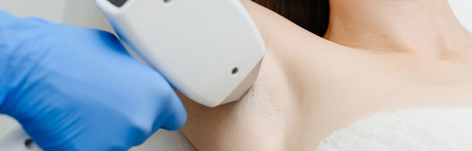 脱毛（女性・1回）