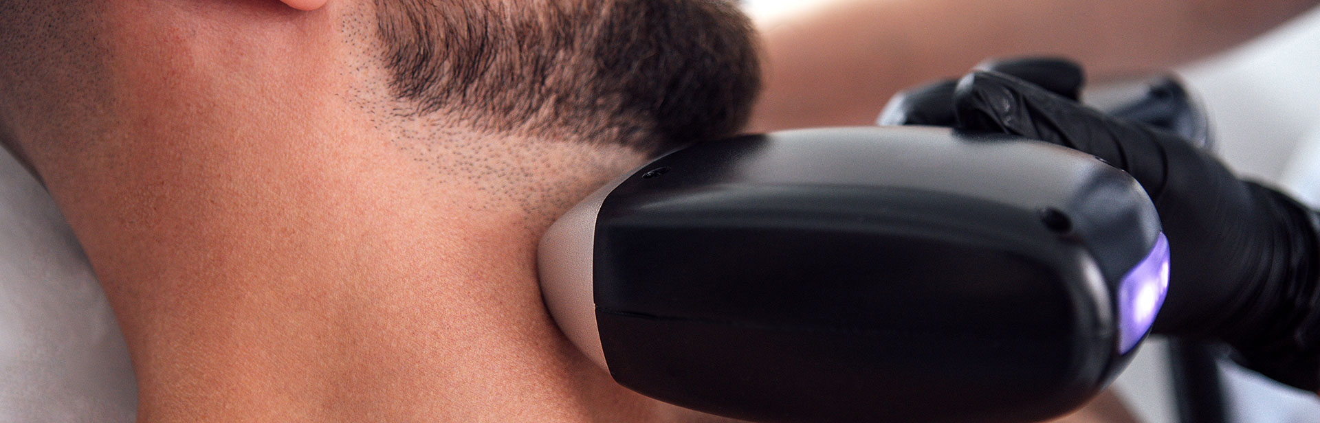 脱毛（男性・1回）